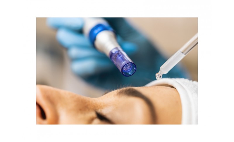 DERMAPEN MICRONEEDLING/ ΜΕΣΟΘΕΡΑΠΕΙΑ ΠΡΟΣΩΠΟ
